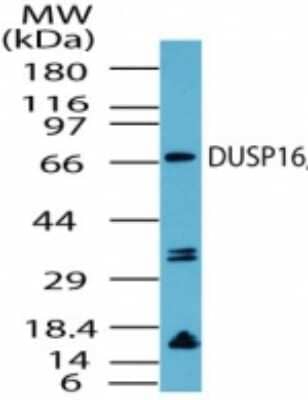 Western Blot: DUSP16 Antibody [NBP2-24501]