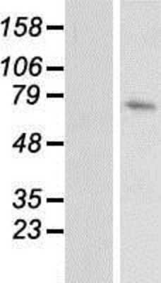 Western Blot: DUSP16 Overexpression Lysate [NBP2-06202]