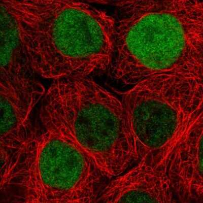 Immunocytochemistry/ Immunofluorescence: DUSP18 Antibody [NBP2-57138]