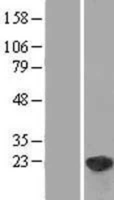 Western Blot: DUSP18 Overexpression Lysate [NBP2-05357]