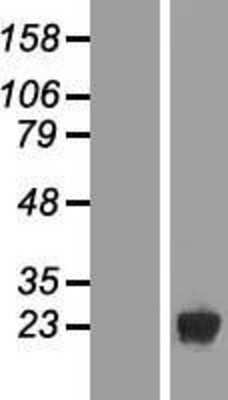 Western Blot: DUSP19 Overexpression Lysate [NBP2-05748]