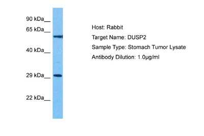 Western Blot: DUSP2 Antibody [NBP2-84829]