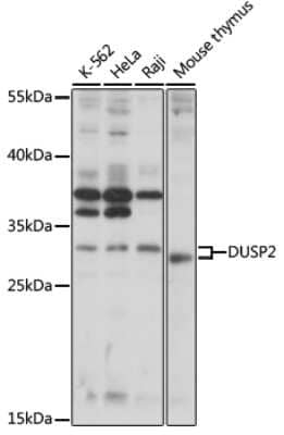 Western Blot: DUSP2 AntibodyAzide and BSA Free [NBP2-92318]