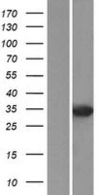 Western Blot: DUSP2 Overexpression Lysate [NBP2-07873]