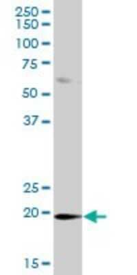 Western Blot: DUSP21 Antibody [H00063904-B01P]