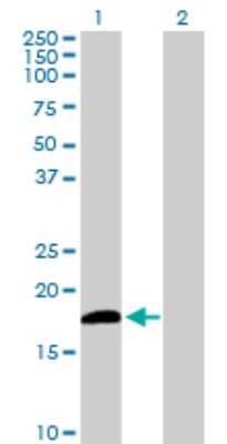 Western Blot: DUSP21 Antibody [H00063904-B01P]
