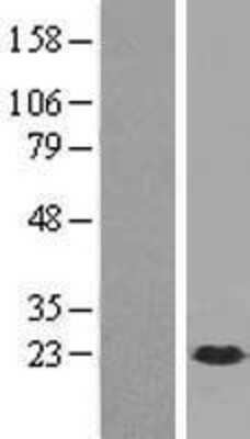 Western Blot: DUSP21 Overexpression Lysate [NBP2-06476]