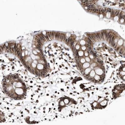 Immunohistochemistry-Paraffin: DUSP22 Antibody [NBP1-83078]