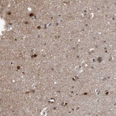 Immunohistochemistry-Paraffin: DUSP22 Antibody [NBP1-83078]