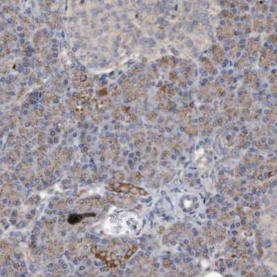 Immunohistochemistry-Paraffin: DUSP22 Antibody [NBP1-83078]