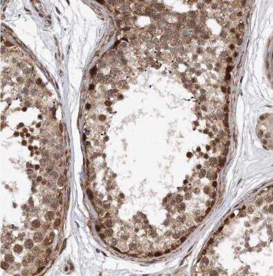 Immunohistochemistry-Paraffin: DUSP22 Antibody [NBP1-83078]