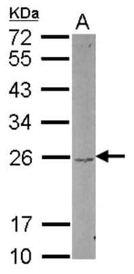 Western Blot: DUSP22 Antibody [NBP2-16239]