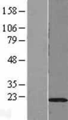 Western Blot: DUSP22 Overexpression Lysate [NBL1-10050]