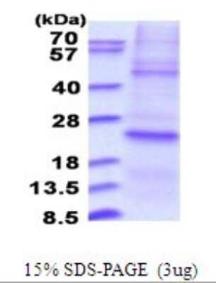 SDS-PAGE: Recombinant Human DUSP22 His Protein [NBP2-51697]