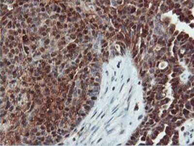 Immunohistochemistry: DUSP23 Antibody (OTI3C10) - Azide and BSA Free [NBP2-71976]