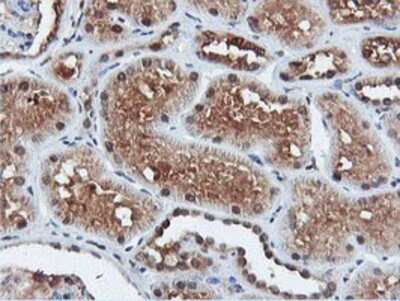 Immunohistochemistry: DUSP23 Antibody (OTI3C10) - Azide and BSA Free [NBP2-71976]