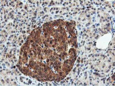 Immunohistochemistry: DUSP23 Antibody (OTI3C10) - Azide and BSA Free [NBP2-71976]