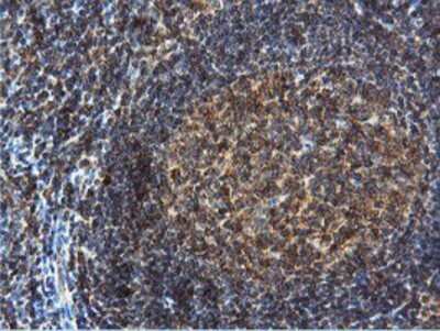 Immunohistochemistry: DUSP23 Antibody (OTI3C10) - Azide and BSA Free [NBP2-71976]