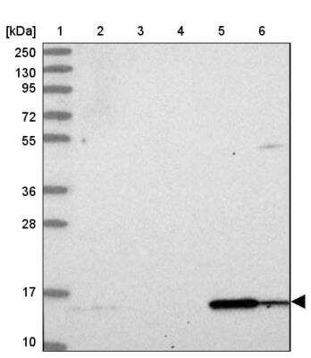 Western Blot: DUSP23 Antibody [NBP1-91855]