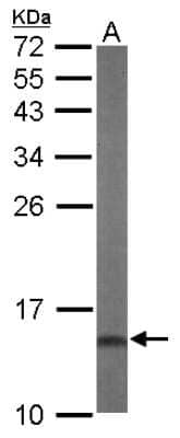 Western Blot: DUSP23 Antibody [NBP2-16240]