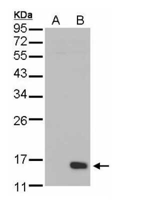 Western Blot: DUSP23 Antibody [NBP2-16240]