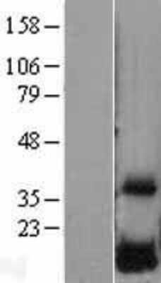 Western Blot: DUSP23 Overexpression Lysate [NBL1-10051]