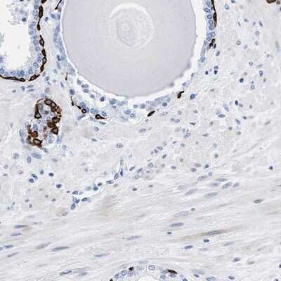 Immunohistochemistry: DUSP26 Antibody [NBP2-33880]
