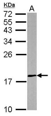 Western Blot: DUSP26 Antibody [NBP1-31254]