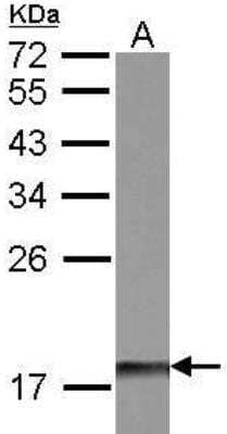 Western Blot: DUSP26 Antibody [NBP1-31254]