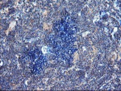 Immunohistochemistry-Paraffin: DUSP27/DUPD1 Antibody (OTI7E4) [NBP2-03339]