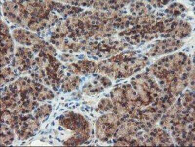 Immunohistochemistry-Paraffin: DUSP27/DUPD1 Antibody (OTI7E4) [NBP2-03339]