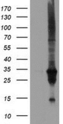 Western Blot: DUSP27/DUPD1 Antibody (OTI7E4) [NBP2-03339]