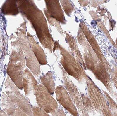 Immunohistochemistry-Paraffin: DUSP27/DUPD1 Antibody [NBP1-84040]