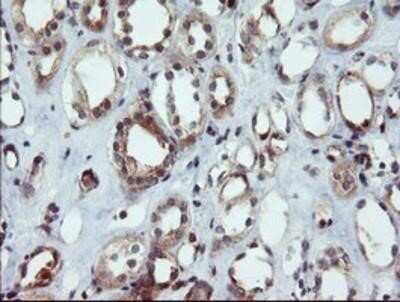 Immunohistochemistry: DUSP27/DUPD1 Antibody (OTI7E4) - Azide and BSA Free [NBP2-72503]