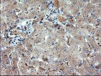 Immunohistochemistry: DUSP27/DUPD1 Antibody (OTI7E4) - Azide and BSA Free [NBP2-72503]