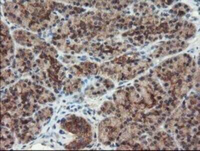 Immunohistochemistry: DUSP27/DUPD1 Antibody (OTI7E4) - Azide and BSA Free [NBP2-72503]
