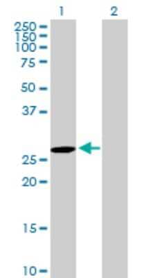 Western Blot: DUSP27/DUPD1 Antibody [H00338599-B01P]