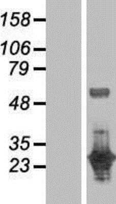 Western Blot: DUSP27/DUPD1 Overexpression Lysate [NBP2-10742]