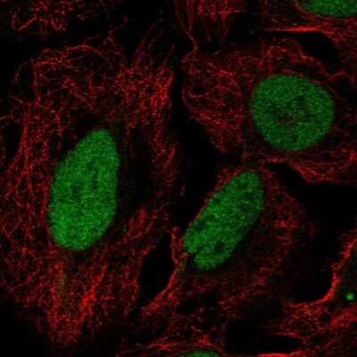 Immunocytochemistry/ Immunofluorescence: DUSP27 dual specificity phosphatase 27 Antibody [NBP2-55286]