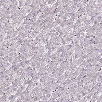 Immunohistochemistry-Paraffin: DUSP28 Antibody [NBP1-94058]