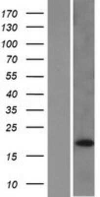 Western Blot: DUSP28 Overexpression Lysate [NBP2-08625]