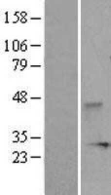 Western Blot: VHR/DUSP3 Overexpression Lysate [NBL1-10053]