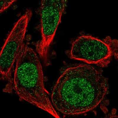 Immunocytochemistry/ Immunofluorescence: DUSP4 Antibody [NBP2-56808]