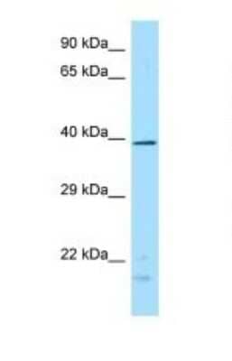 Western Blot: DUSP4 Antibody [NBP1-98449]