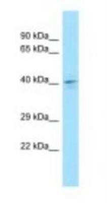 Western Blot: DUSP4 Antibody [NBP1-98499]