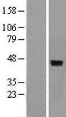 Western Blot: DUSP4 Overexpression Lysate [NBL1-10054]