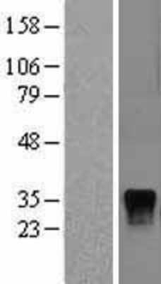 Western Blot: DUSP4 Overexpression Lysate [NBL1-10055]