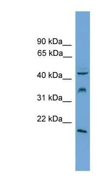 Western Blot: DUSP5 Antibody [NBP1-79716]