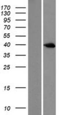 Western Blot: MKP-3/DUSP6 Overexpression Lysate [NBL1-10058]