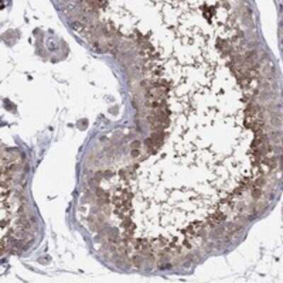 Immunohistochemistry-Paraffin: DUSP7 Antibody [NBP3-17836]